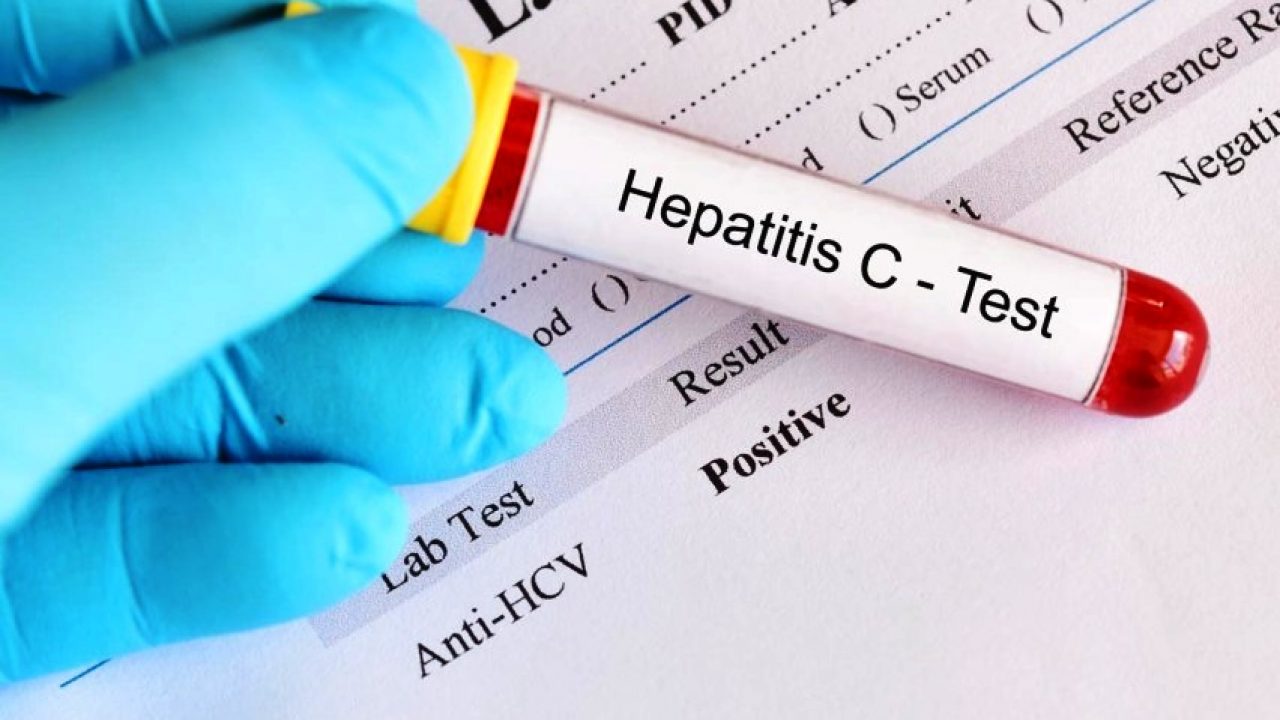 Epatite C, 6 milioni per lo screening gratuito in Sicilia