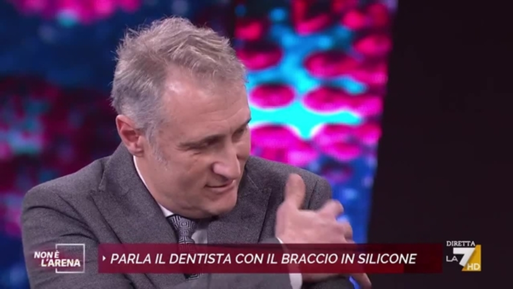 No vax che andò a fare vaccino con braccio in silicone, “Mi sono vaccinato”