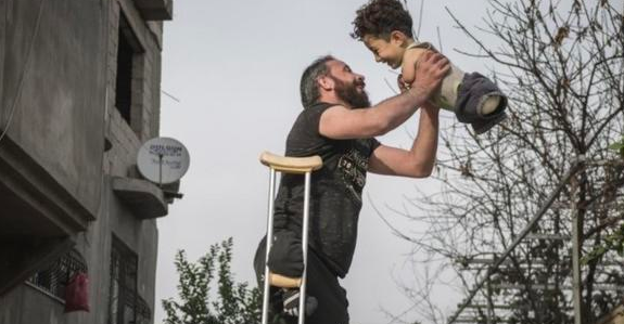 Papà e figlio senza arti in foto Siria, cosa li aspetta in Italia