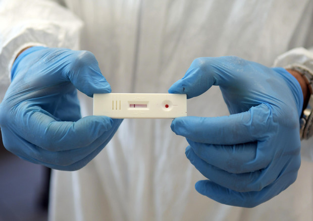 Covid, test rapido di autodiagnosi positivo con acqua di rubinetto, il caso