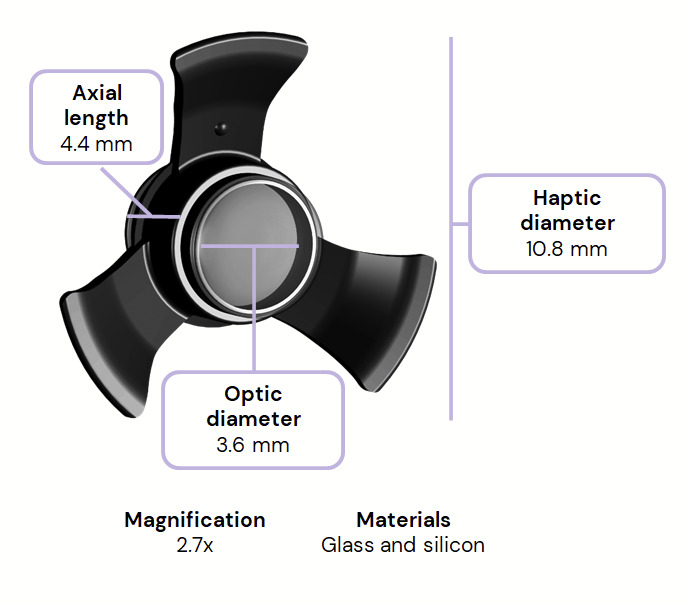 Maculopatia, intervento con telescopio salvavista: pazienti operabili e costi