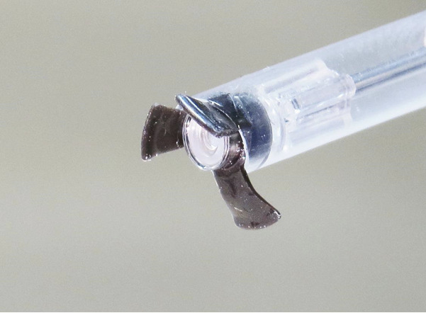 Maculopatia, intervento con telescopio salvavista: pazienti operabili e costi