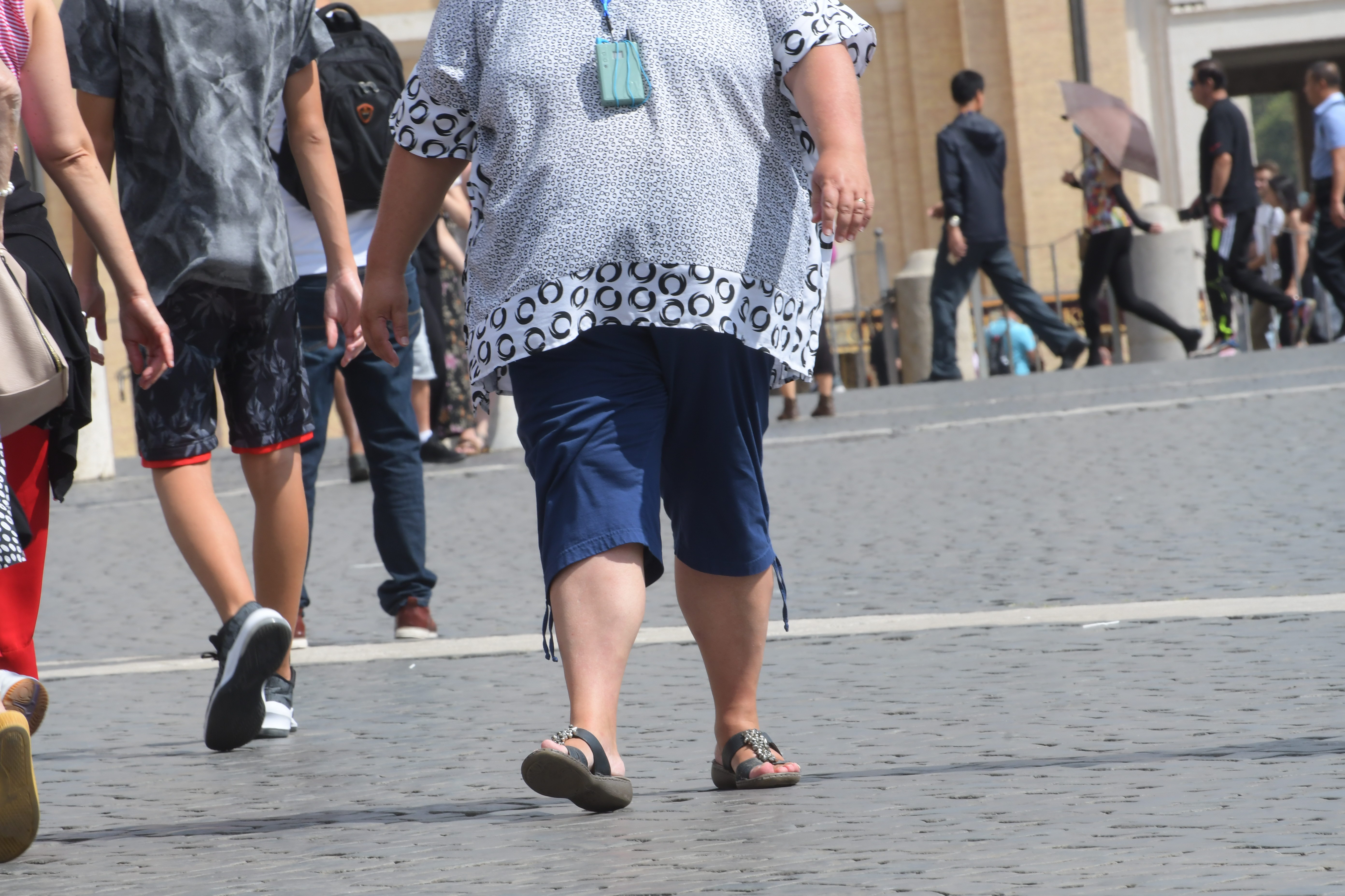 Obesità, patologia in aumento anche tra i più piccoli: perché non trascurarla