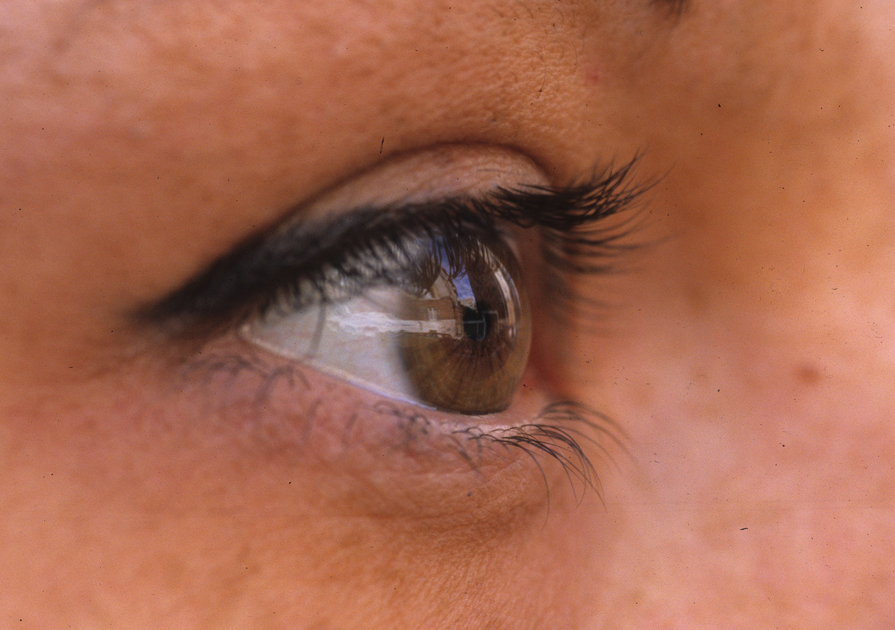 Maculopatia senile, medico catanese restituisce la vista a quattro pazienti