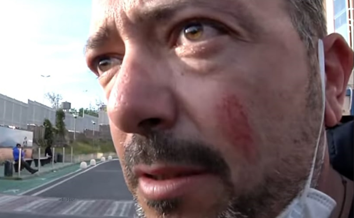 Pedara, autista scuolabus aggredito: “Preso a pugni per aver fatto il mio lavoro”