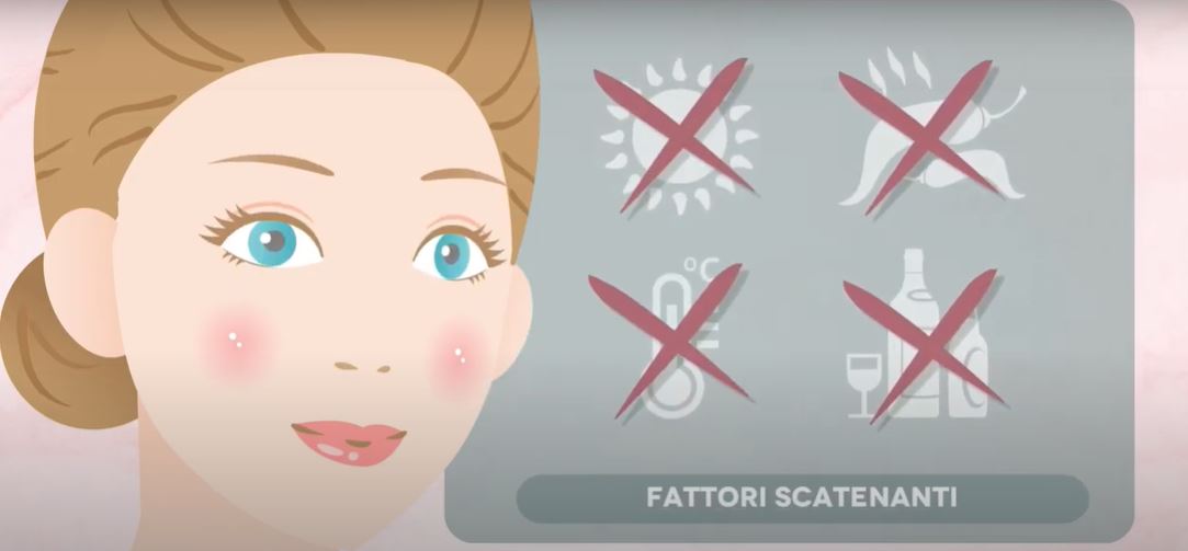 Rosacea, aprile mese dedicato alla malattia della pelle, cos’è, come si manifesta