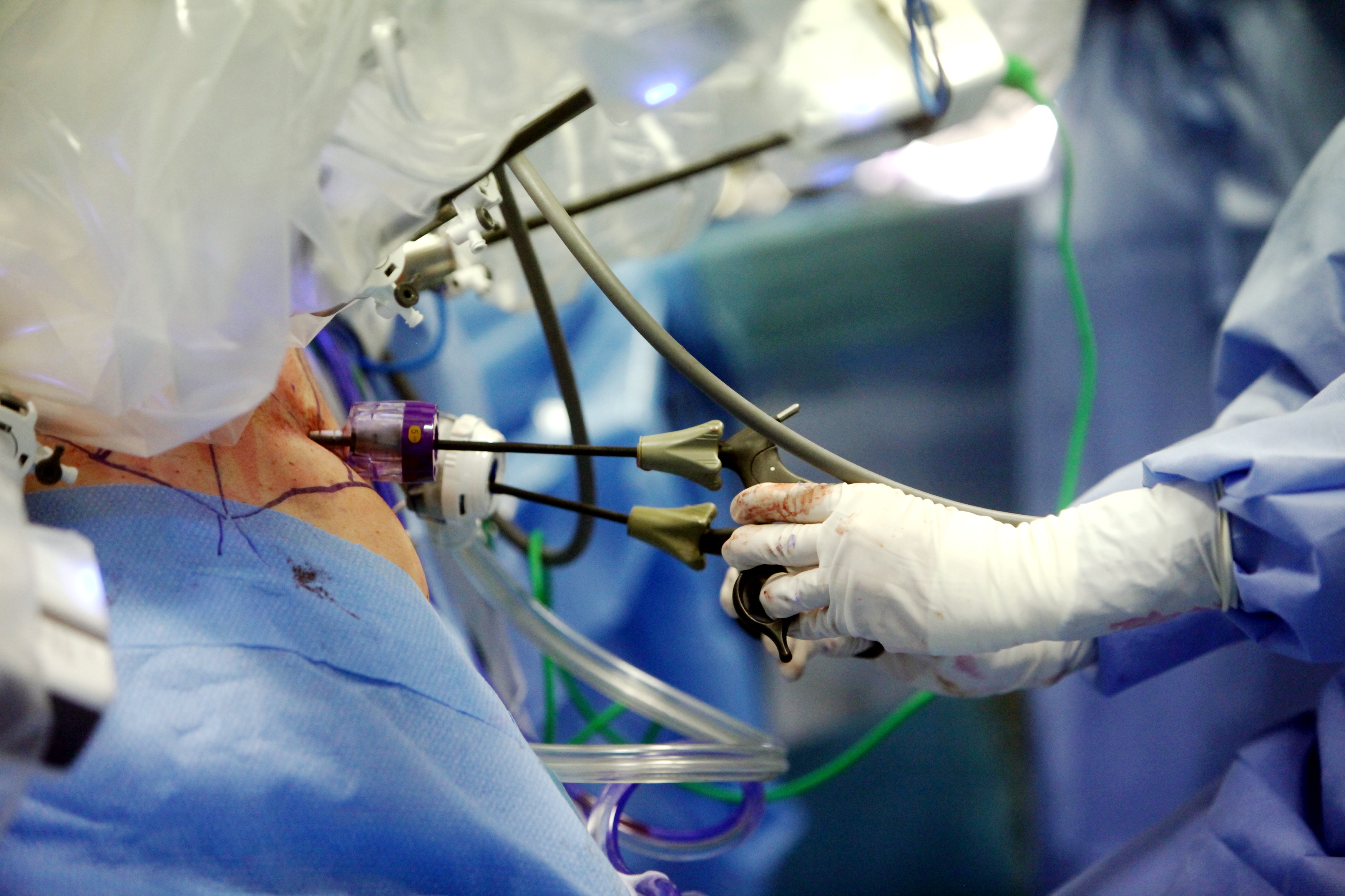 Morta dopo intervento estetico per obesità: gli avvertimenti dello specialista