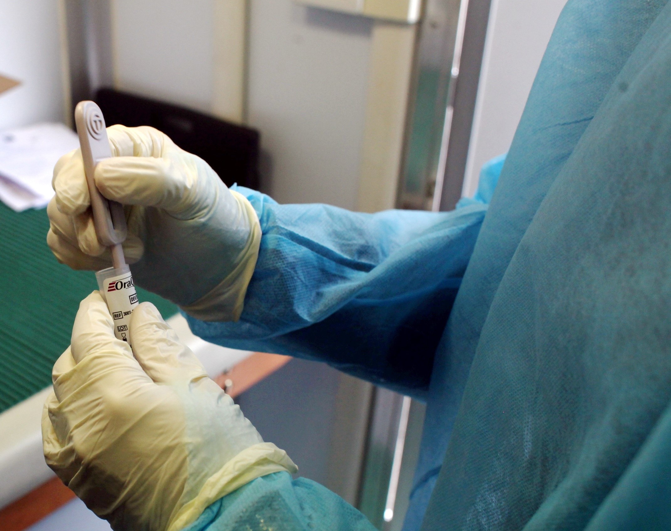 Sanità: epatite misteriosa bambini, si allarga l’allarme