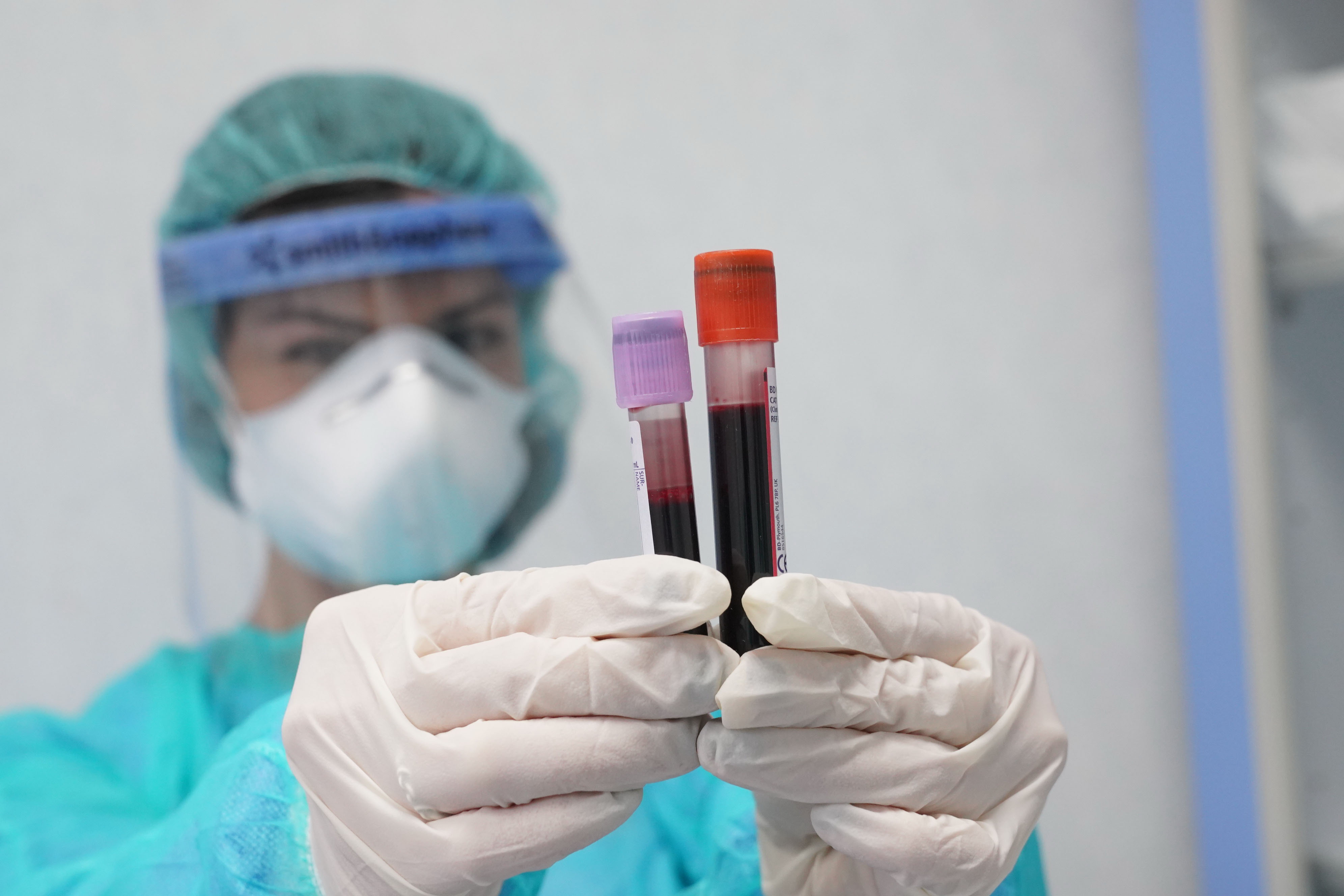 Covid, Pregliasco: “Onde sostenute da varianti, mi aspetto nuova fiammata”