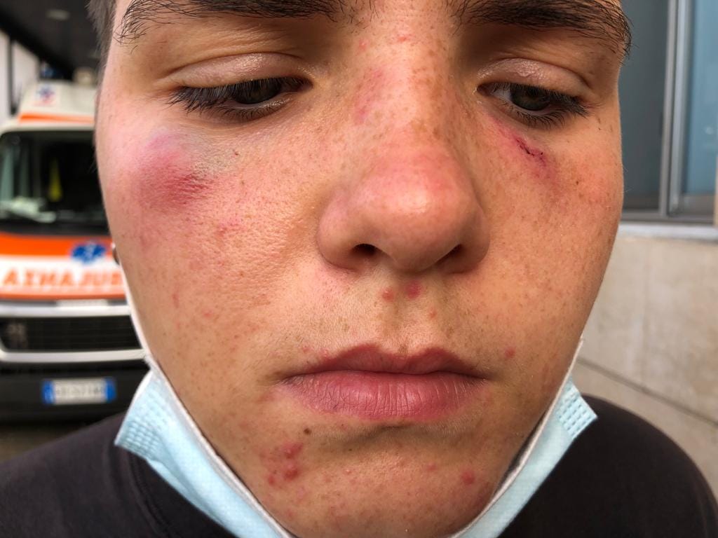 “Picchiata per il mio orientamento sessuale”, la storia di Giada a Palermo “Picchiata per il mio orientamento sessuale”, la storia di Giada a Palermo