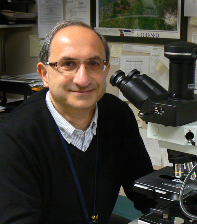 Fibrosi polmonare, importante scoperta di tre ricercatori siciliani in Usa