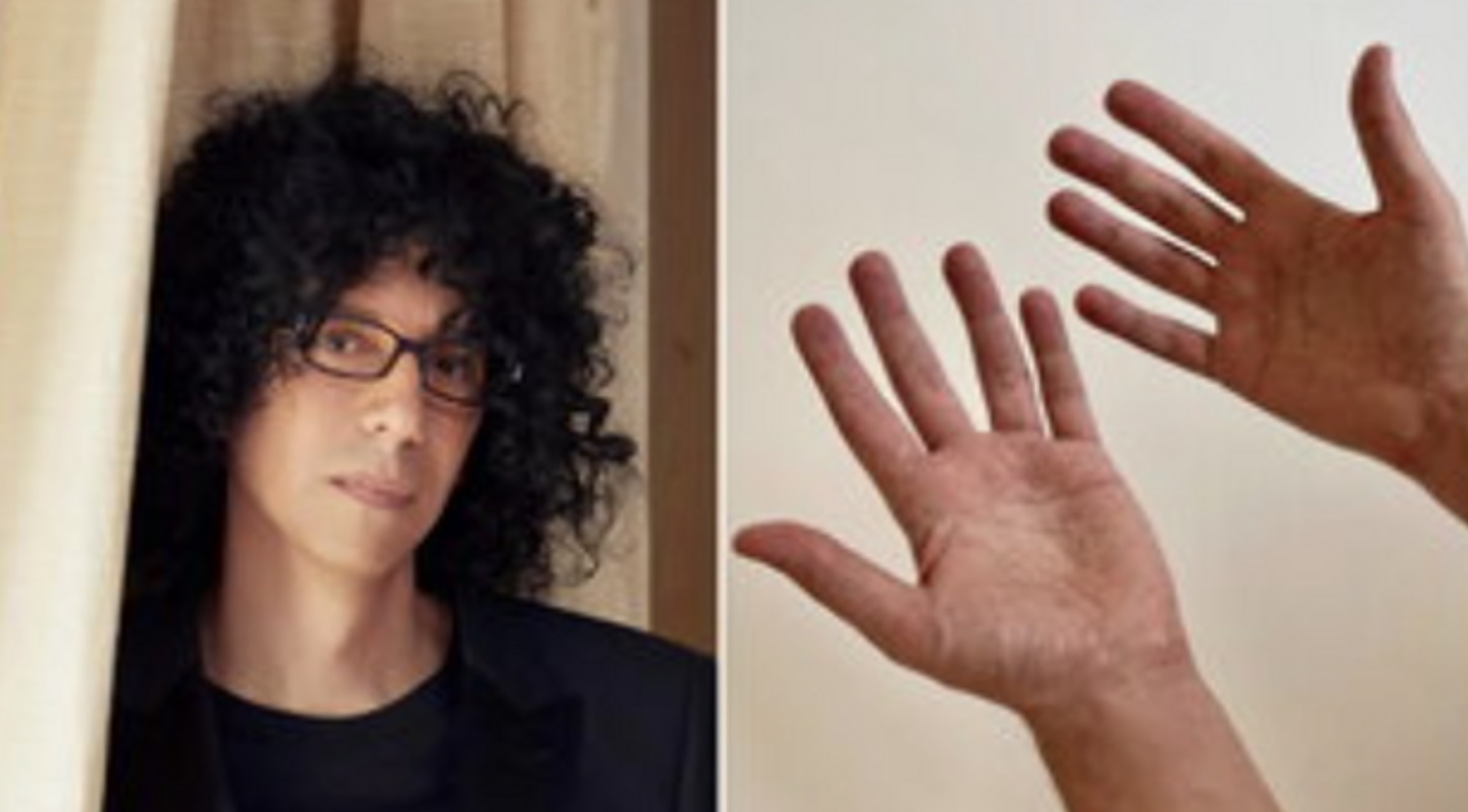 Giovanni Allevi: “Le mani tremano per i farmaci, non posso suonare”