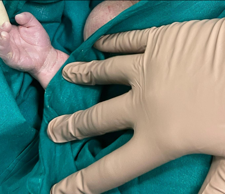 Gioia e dolore per Ciro Immobile, nato il quarto figlio ma arriva lungo stop per infortunio Gioia e dolore per Ciro Immobile, nato il quarto figlio ma arriva lungo stop per infortunio