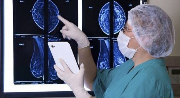 Cancro al seno metastatico sempre più guaribile: il 20% delle donne supera la malattia