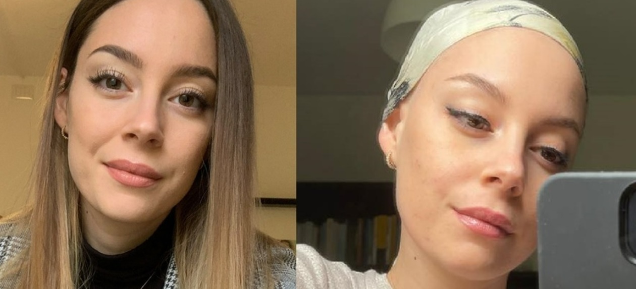 Alice Manfrini, addio alla TikToker che raccontava la sua lotta contro il tumore