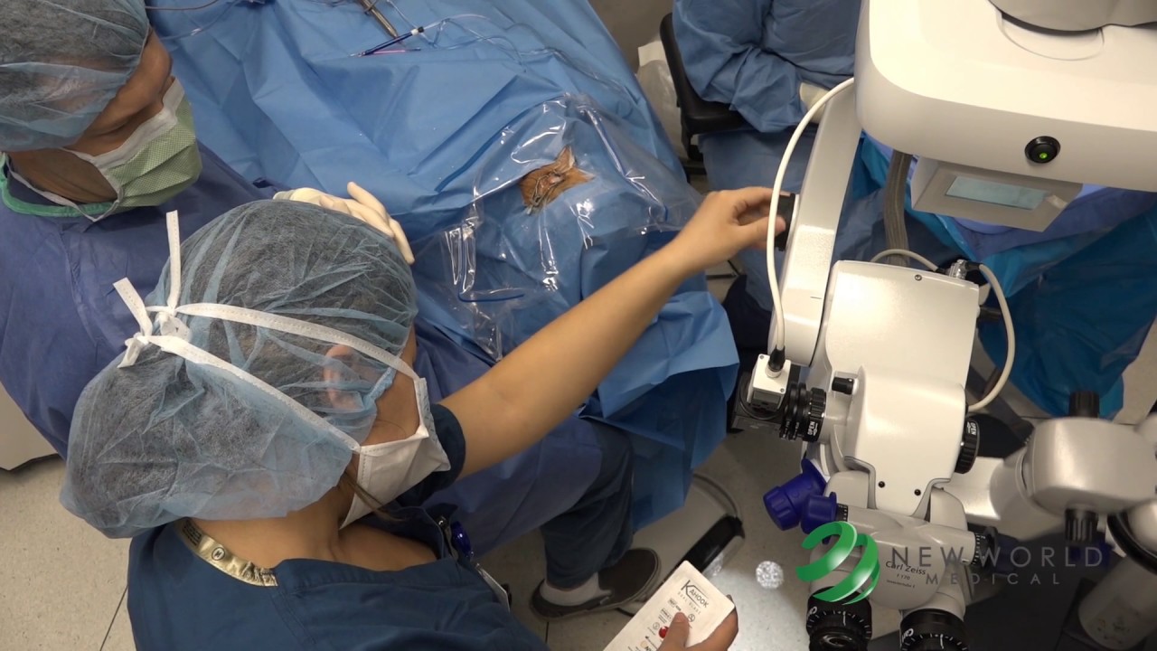 Eccezionale intervento di oculistica a Roma: ragazza di 18 anni torna a vedere