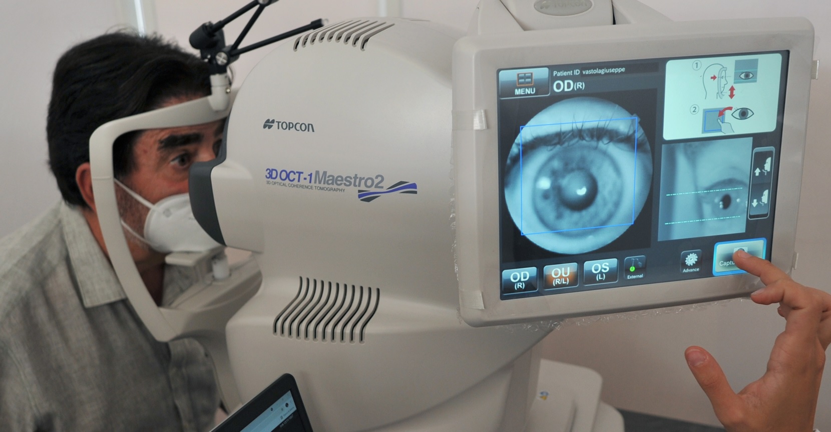 Oltre 4 italiani su 10 hanno problemi agli occhi, ecco la dieta salva vista