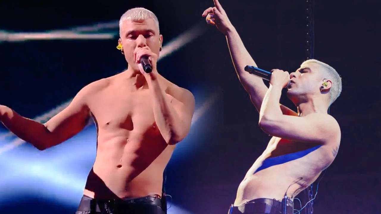 Fedez senza tatuaggi a X Factor: ecco come li ha rimossi