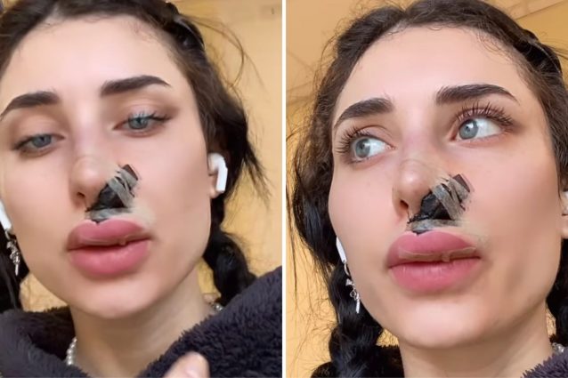 Greta Menchi aggredita e sfregiata da un cane: le foto choc