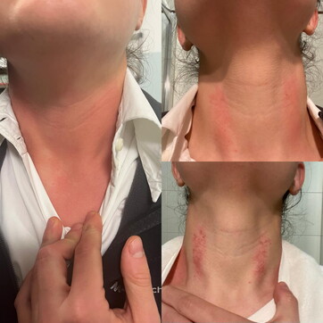 Tenta di strangolare la guardia medica e fugge: le foto shock dell’aggressione sui social