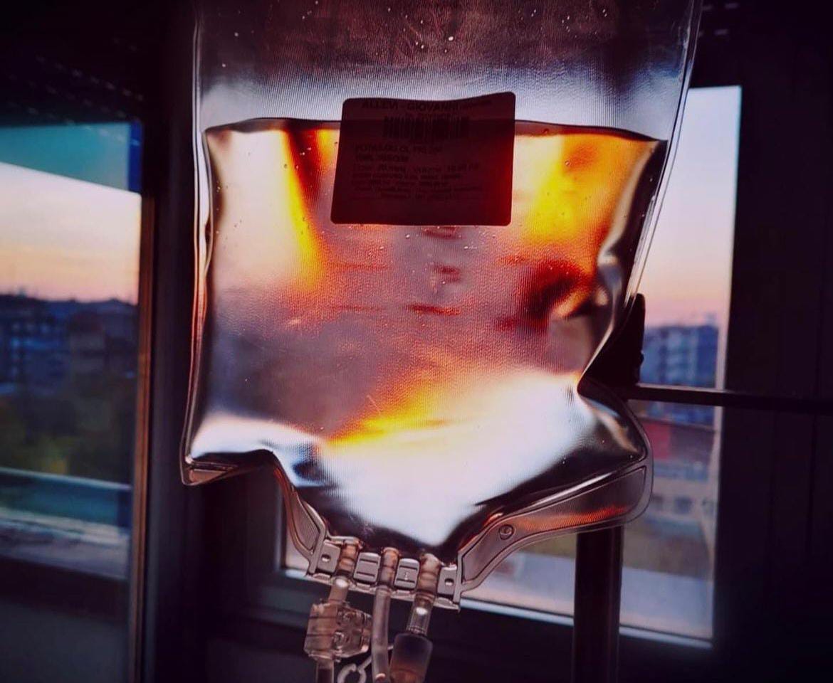 Giovanni Allevi e la battaglia al mieloma: “Cerco la bellezza in ogni momento”