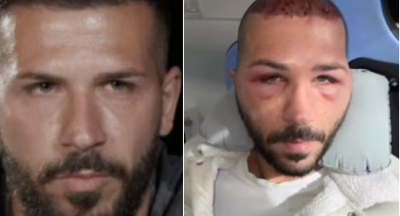 Federico Rasa “scatenato” al pronto soccorso di Palermo, è indagato per danneggiamento