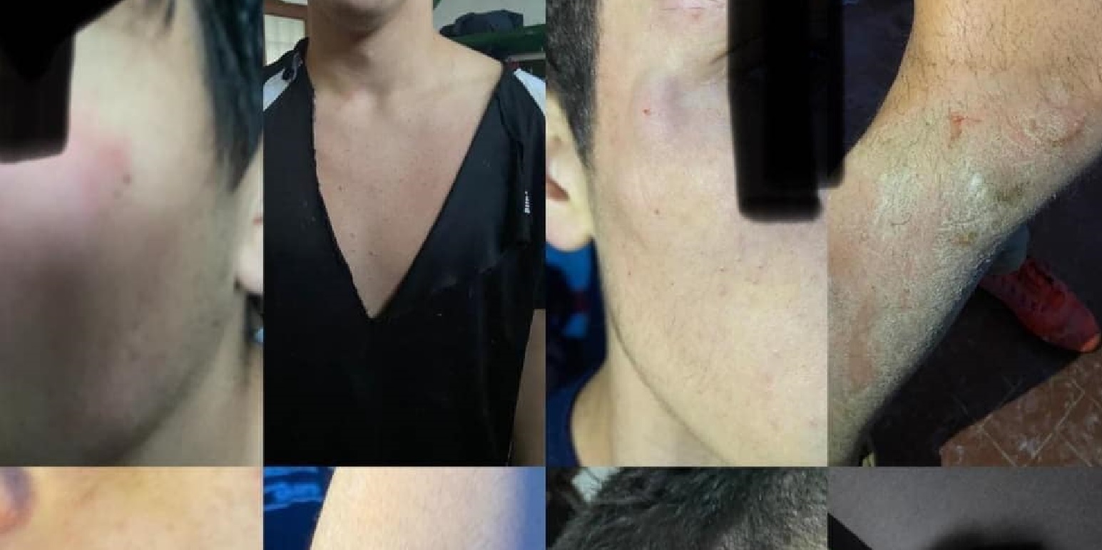 Aggressione e rissa durante una partita under 17 nel Palermitano, feriti e denunce