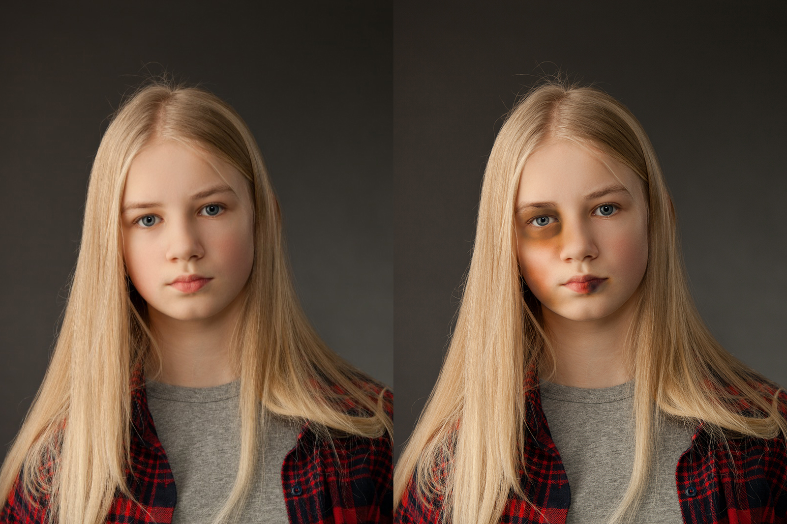 Violenza contro i minori, Serie A in campo  per accendere le luci su una piaga invisibile