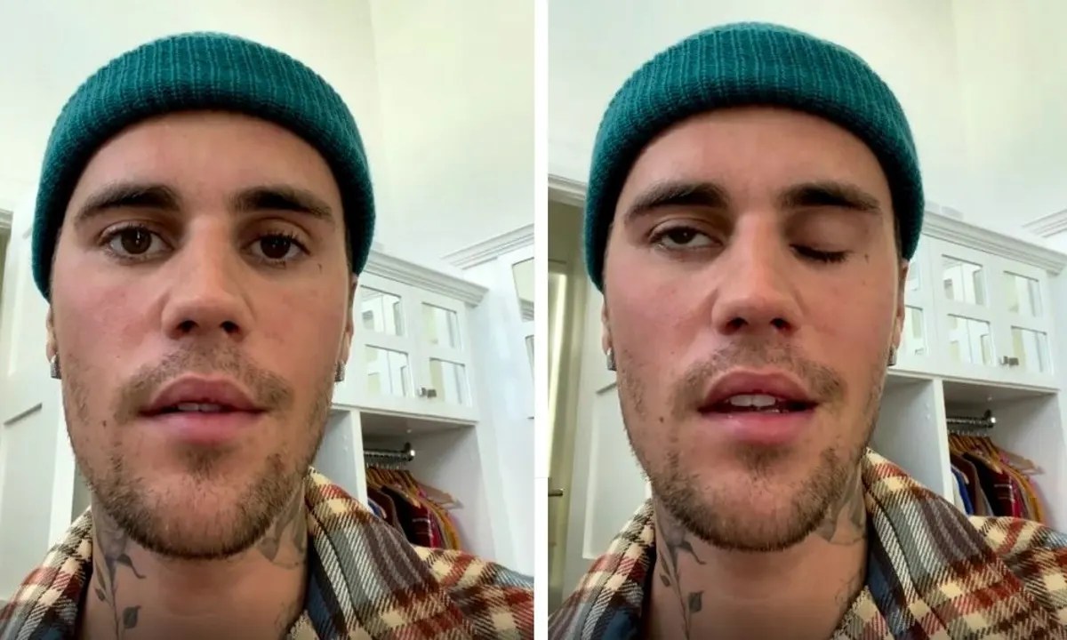Justin Bieber ha la sindrome di Ramsay Hunt: salta il “World Tour”