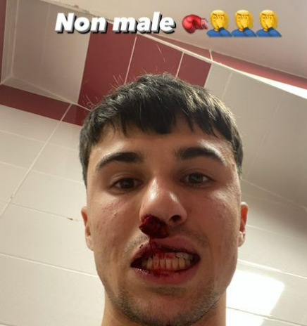 Sivasspor-Fiorentina, tifoso entra in campo e colpisce Bianco con pugno in faccia