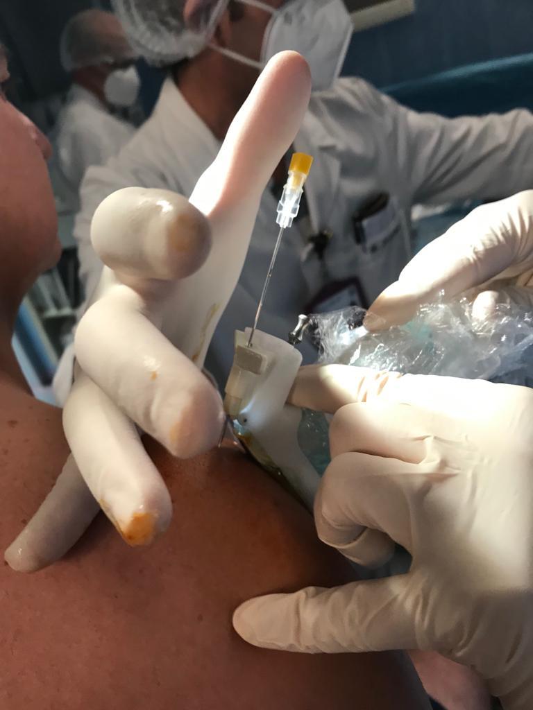 Rigenerazione dei tendini e delle articolazioni: innovativo trattamento con la staminali a Palermo