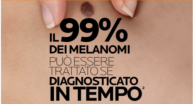 Catania, screening gratuiti per la prevenzione del melanoma al Policlinico