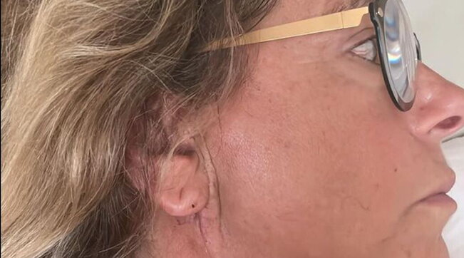 Grande Fratello, il dramma di Roberta Beta: “Sono stata operata per un adenoma”