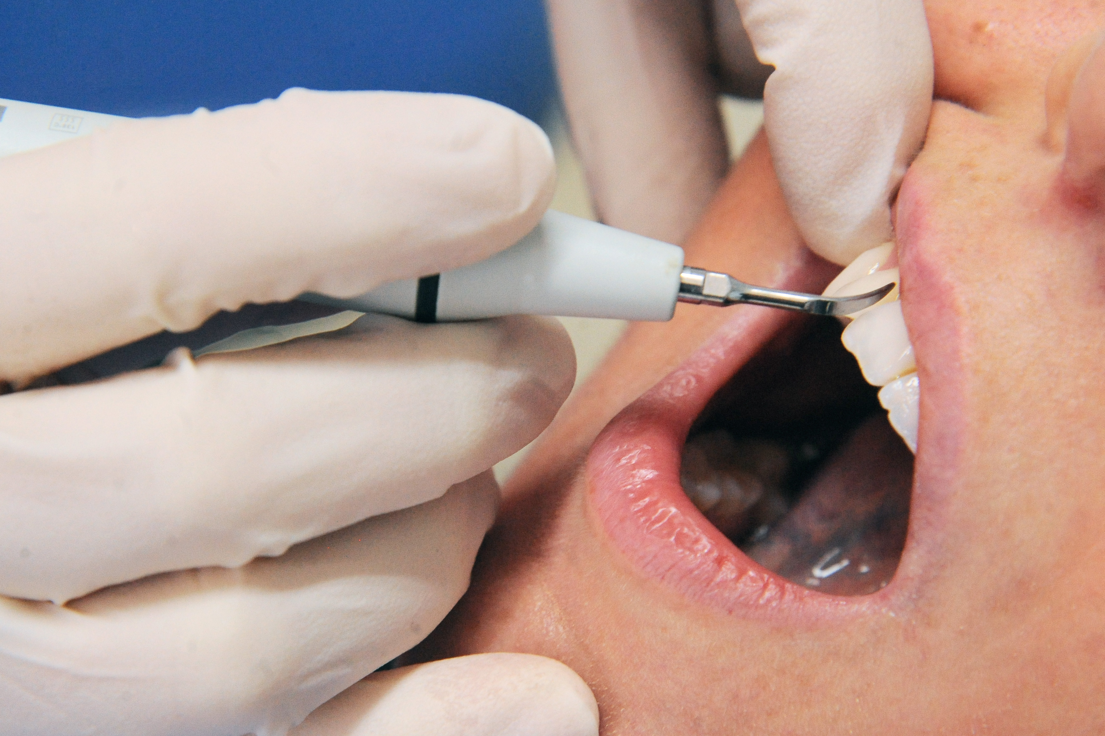 Lavoro in Sicilia, Visodent cerca personale: ecco le sedi e come candidarsi Lavoro in Sicilia, Visodent cerca personale: ecco le sedi e come candidarsi