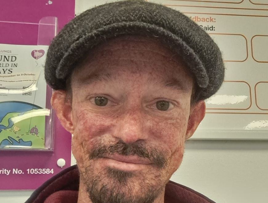 Morto a 36 anni l’attore Darren Kent de “Il Trono di Spade”: ecco chi era