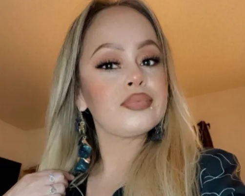 Mangia del pesce contaminato da batterio e va in coma, amputate braccia e gambe a 40enne Mangia del pesce contaminato da batterio e va in coma, amputate braccia e gambe a 40enne