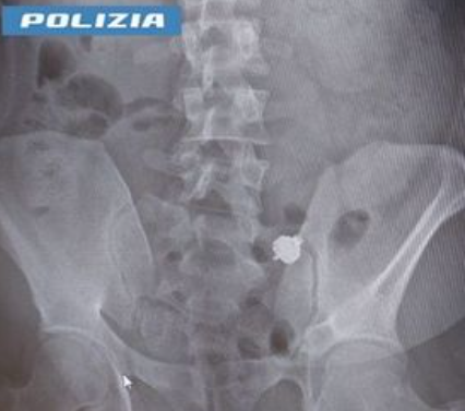 Incredibile gesto durante esame per la patente: scoperto con l’auricolare lo ingoia: denunciato