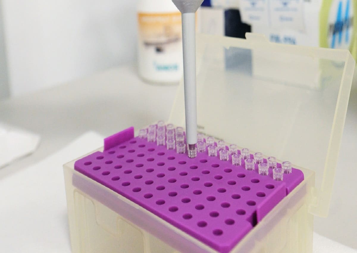 Stop ai laboratori analisi, scatta lo sciopero anche in Sicilia: ecco quando e perché