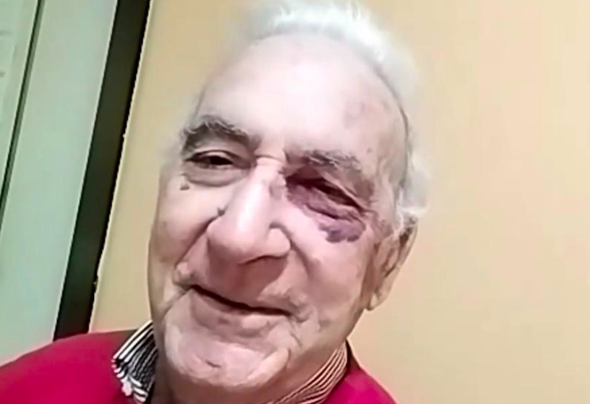 Messina, 84enne picchiato in strada davanti al nipote: denunciato un minore