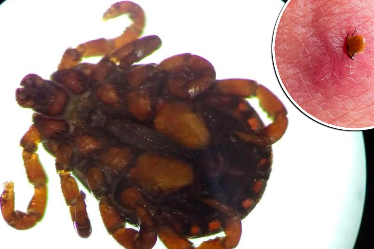 Cos’è IL WELV, tutto quello che c’è da sapere sul nuovo virus scoperto in Cina