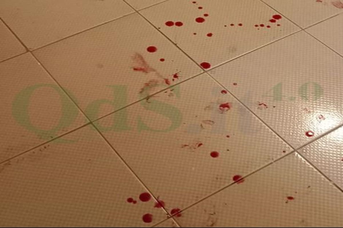 Shock a Villaggio Peruzzo, tentato omicidio all’alba: padre accoltella figlia, arrestato