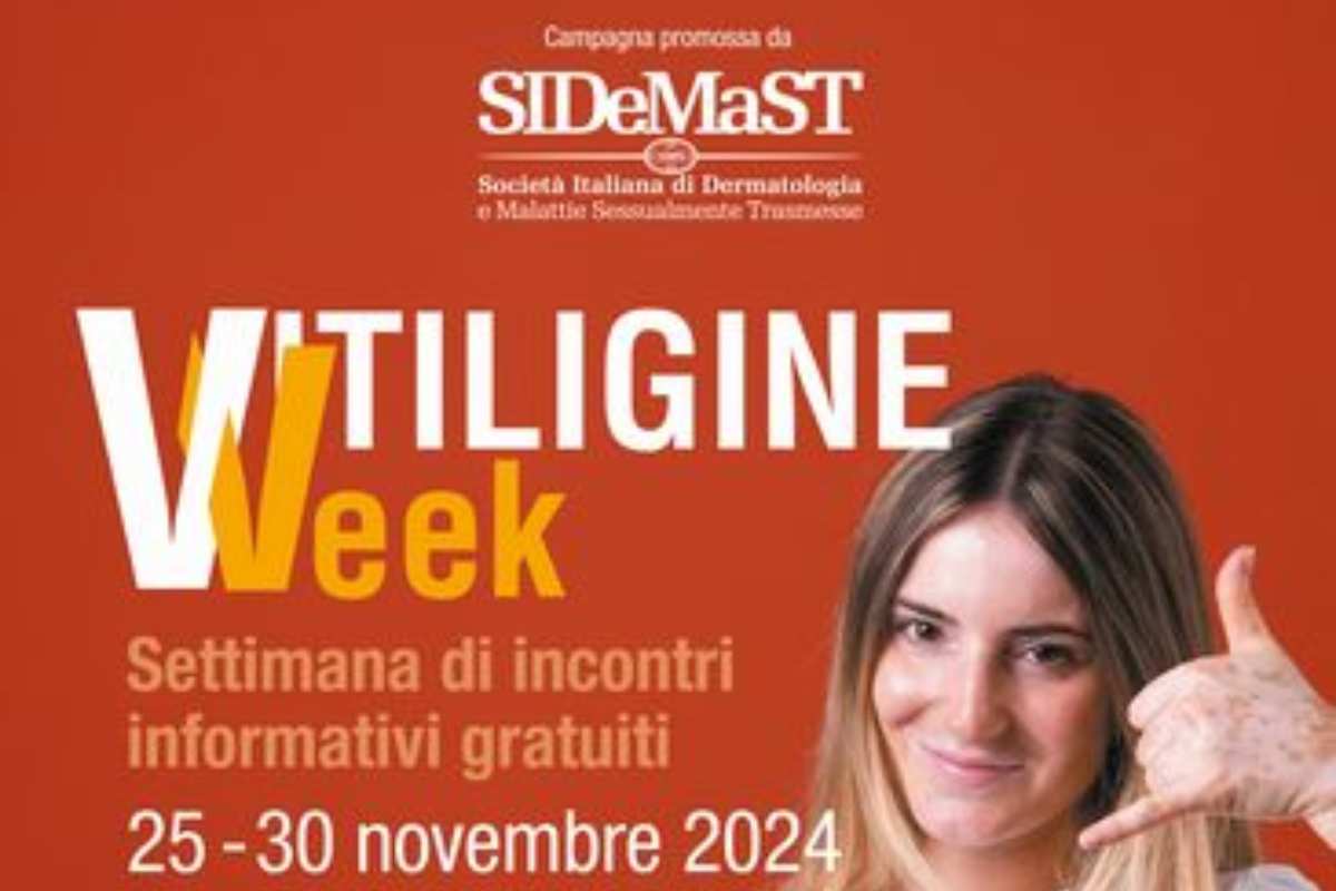 La ‘Vitiligine Week’ arriva in Sicilia: incontri gratuiti con i dermatologi