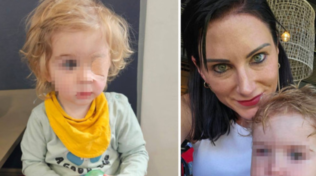 Uomo con herpes gli da un bacio, bimbo diventa cieco: “L’egoismo ha tolto la vista a mio figlio”