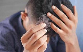 Il dermatologo: “Con alopecia areata disagi e costi alti, svecchiare linee guida”