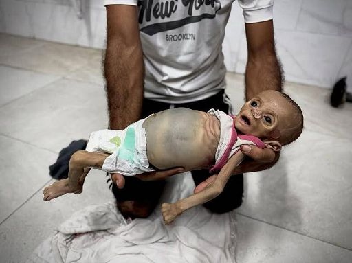 Gaza, Conte a Fdi: ecco altre immagini denutriti, scaricate Netanyahu