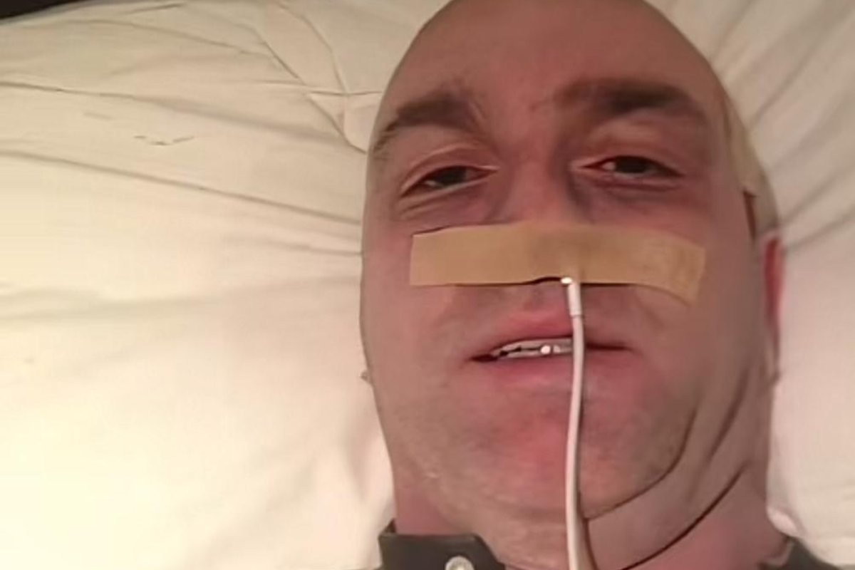 Ex atleta truffa dei fan fingendo di essere malato di tumore con un cavo iPhone infilato nel naso