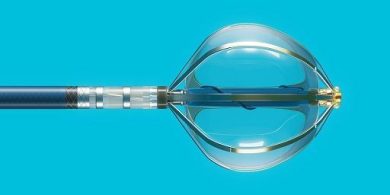 Fibrillazione atriale, arriva un sistema di ultima generazione