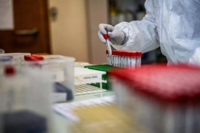 L’aspirina contro il Covid: ecco come frena il virus secondo un nuovo studio