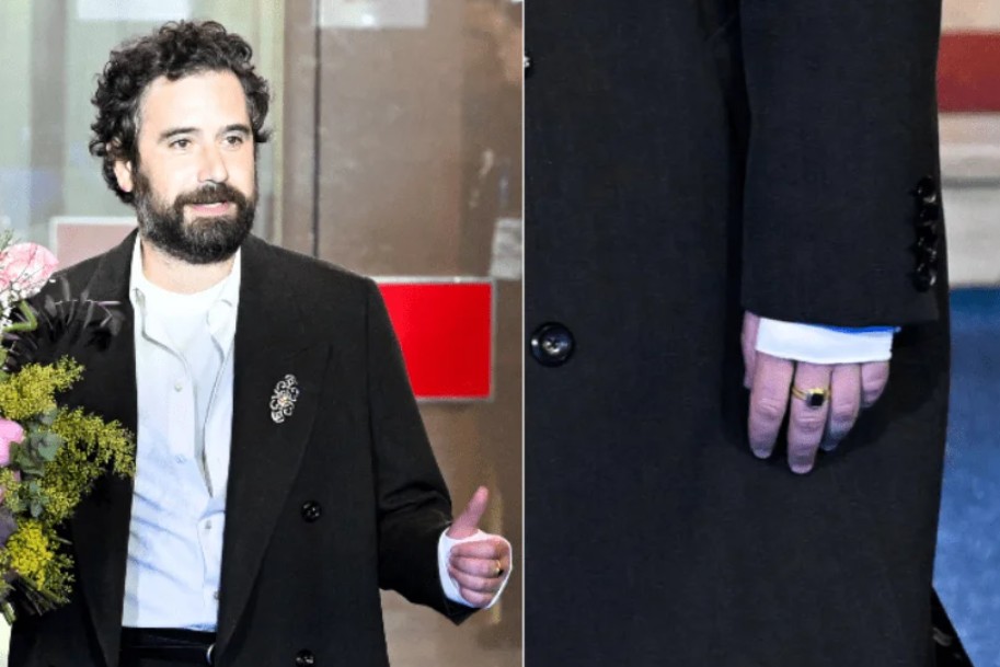 Tommaso Paradiso con la mano fasciata - Adnkronos