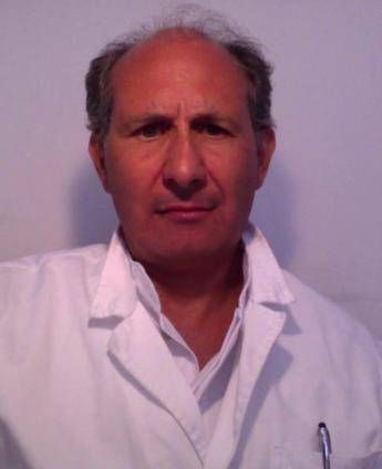 ‘Faccia a luna piena’ e pelle sottile, è la sindrome di Cushing. Cos’è e come si cura